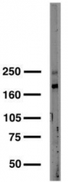 MO50006-100 - CACNA1C