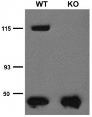 MO50010-100 - TRPC5 / TRP5