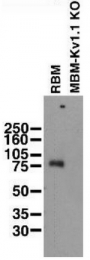 MO50015-100 - KCNA1