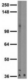 MO50019-100 - KCNB1