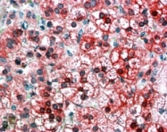 NB100-1011 - Axin-1