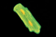 NB100-1908 - Tropomyosin-1 (TPM1)