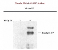NB100-227 - BRCA1 / RNF53