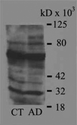 NB100-63093 - 4-Hydroxy-2-Nonenal / HNE