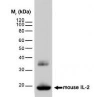 NB100-63299 - Interleukin-2 / IL2