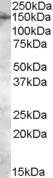 NB100-810 - TRPM7