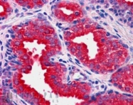 NB100-834 - DUSP1 / MKP1