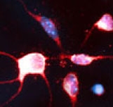 NB100-91274 - RhoB