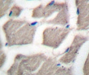 NB100-91673 - Bcl-2-like 7
