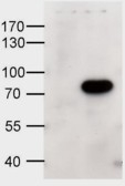 NB100-96913 - ABCD1 / ALDP