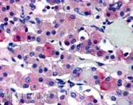 NB100-96917 - Vasopressin V1b receptor (V1bR)