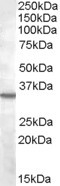 NB100-96919 - BDKRB1