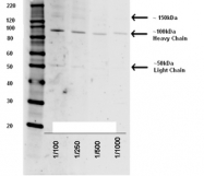 NB100-63239 - Tetanus toxin