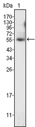 NBP1-28856 - ETV4 / PEA3