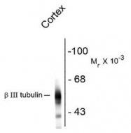 NBP1-30048 - TUBB3 / TUBB4