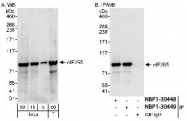 NBP1-30448 - EIF2B5 / EIF2BE
