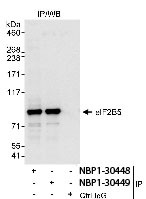 NBP1-30449 - EIF2B5 / EIF2BE