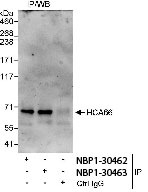 NBP1-30467 - UTP6