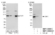 NBP1-30481 - TOP1 / SCL-70