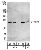 NBP1-30482 - TOP1 / SCL-70