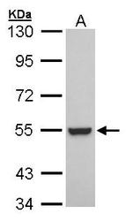 NBP1-30897 - RXR-beta / RXRB