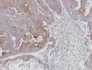 NBP1-30905 - MAPK9 / JNK2