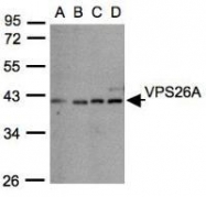 NBP1-30909 - VPS26A