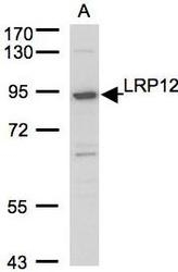 NBP1-30913 - LRP12 / ST7