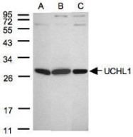 NBP1-30933 - UCHL1 / PGP9.5
