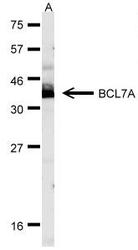 NBP1-30941 - Bcl-7A
