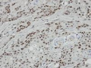 NBP1-30941 - Bcl-7A