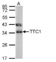 NBP1-30972 - TTC1 / TPR1