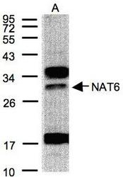 NBP1-30978 - NAT6 / FUS2