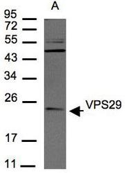 NBP1-30994 - VPS29