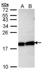 NBP1-30995 - UBE2L3 / UBCH7