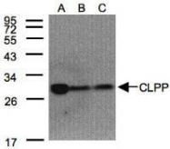 NBP1-31011 - CLPP