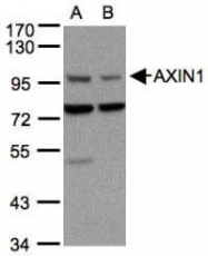 NBP1-31013 - Axin-1