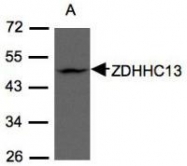 NBP1-31024 - ZDHHC13