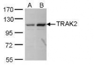 NBP1-31056 - TRAK2 / ALS2CR3
