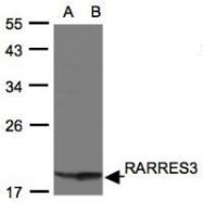 NBP1-31057 - RARRES3