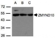 NBP1-31059 - ZMYND10