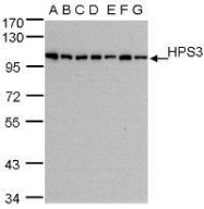 NBP1-31061 - HPS3