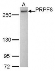NBP1-31067 - DHX16