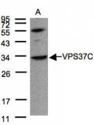 NBP1-31068 - VPS37C