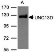 NBP1-31072 - UNC13D