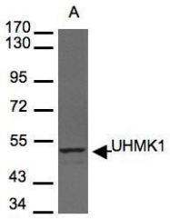 NBP1-31094 - UHMK1 / KIST