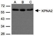 NBP1-31098 - KPNA2 / Importin alpha-2