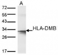 NBP1-31138 - HLA class II DM beta / HLA-DMB