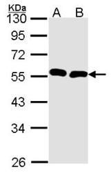NBP1-31151 - BMP9
