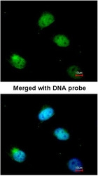 NBP1-31154 - PCBP2 / hnRNP-E2